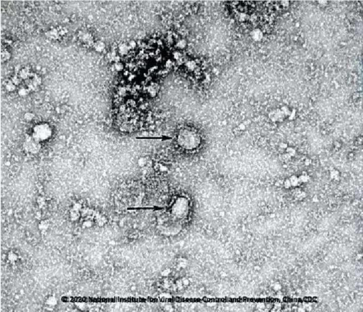 Gambar mikroskopik virus Corona Wuhan 2019-nCoV yang dibagikan oleh Pusat Data Mikrobiologi Nasional Cina.[Pusat Data Mikrobiologi Nasional China/Metro.co.uk]